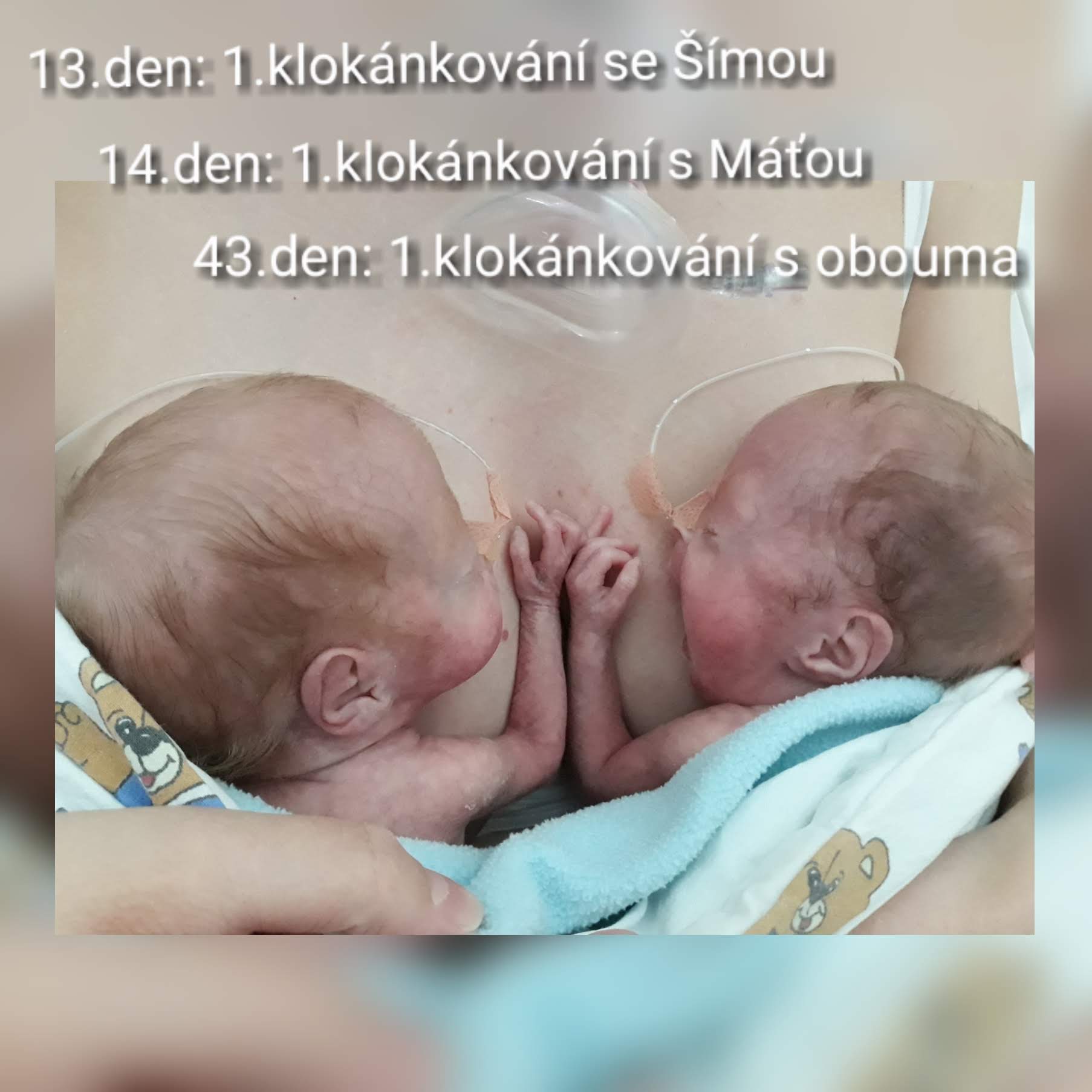 klokankovani-s-obema.jpg klokankovani-s-obema.jpg